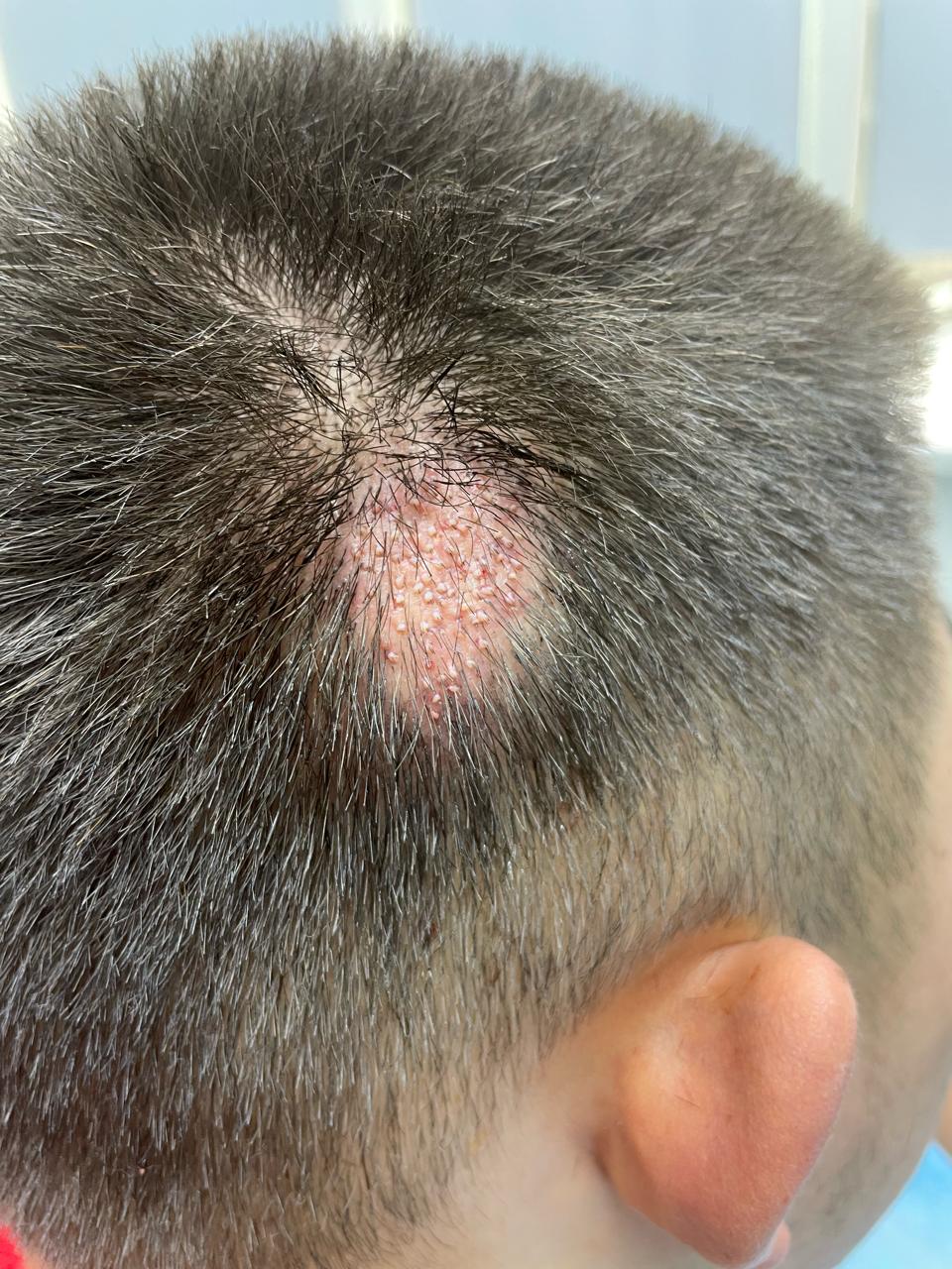 сразу после